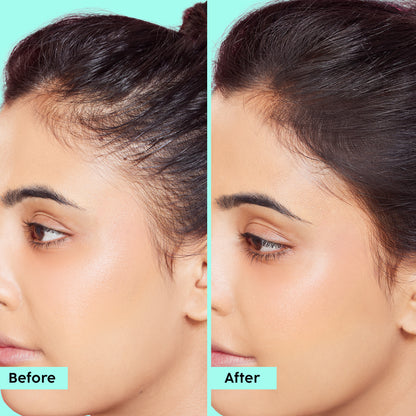 Rosemary Advanced Hair Oil for Stronger Hair Follicles & Healthy Hair Growth