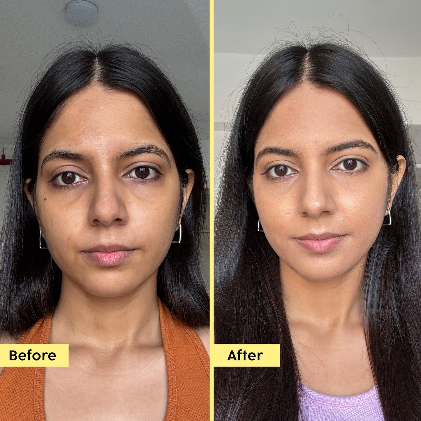 Pineapple Depigmentation Advanced Dewy Sunscreen With SPF 50 PA++++