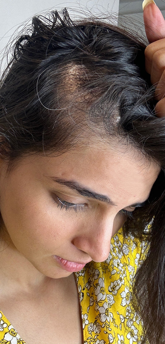 Stress Less, Hair More- Shilpa Rao