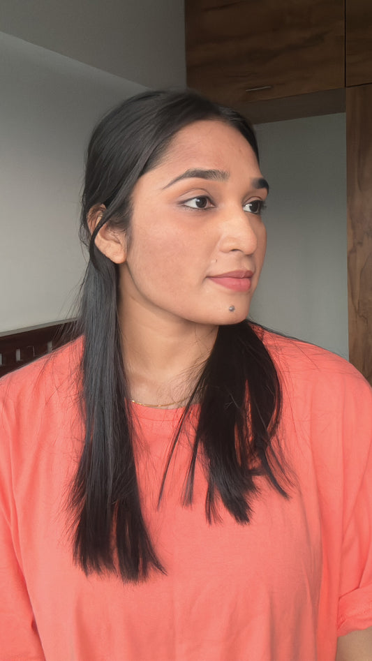 My pigmentation struggle is over - Pranali Mohite