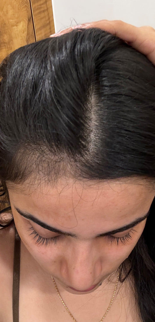 Budget Friendly Boost for Hairfall- Sara Mirwani