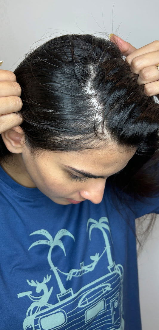 Stress Less, Hair More- Shilpa Rao