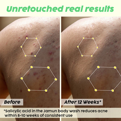 Jamun 2% Salicylic Acid Body Wash For Body Acne, Bumpy Skin