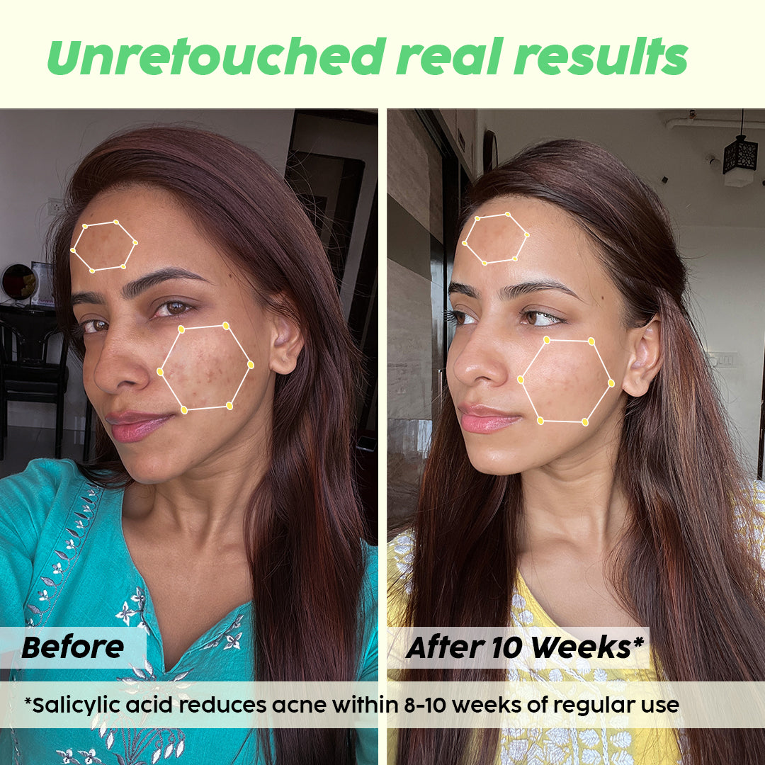 Jamun Mattifying Lightweight Sunscreen With SPA50+ PA+++
