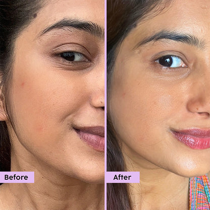 Jamun Clarifying Fruity Toner with 2% Salicylic Acid