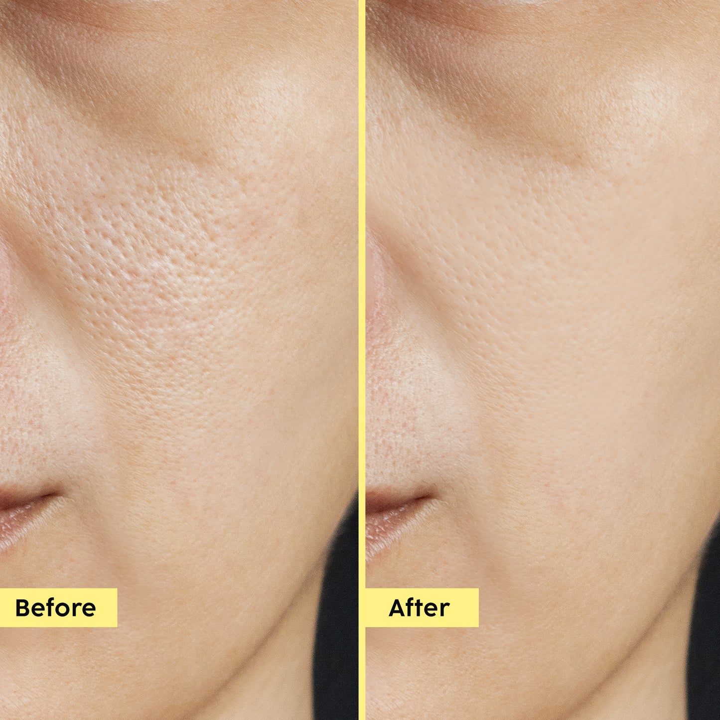 Pineapple Exfoliating Fruity Toner for Smooth, Refined Skin