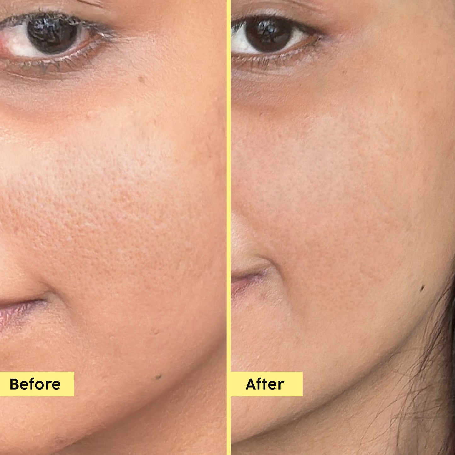 Pineapple Exfoliating Fruity Toner for Smooth, Refined Skin